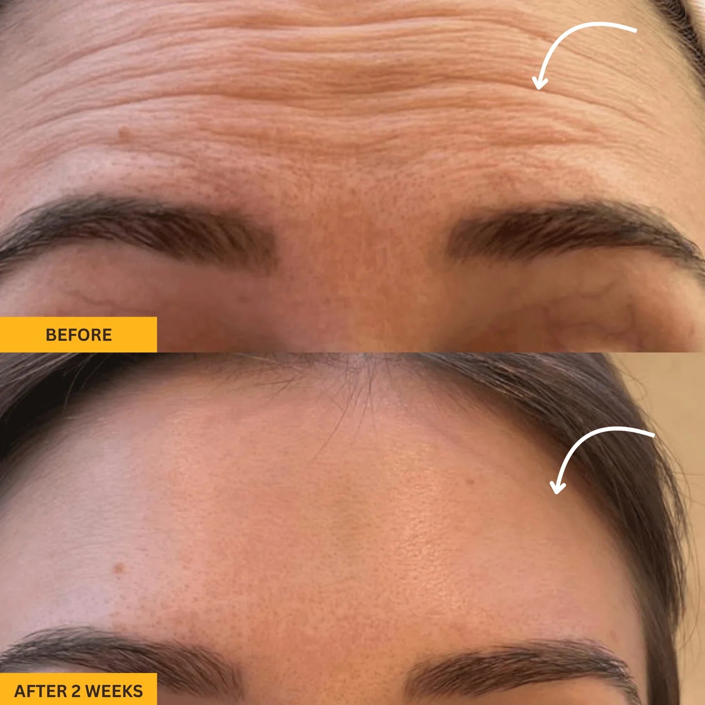 Gua Sha Brush for Snatched Face