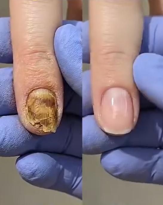 High-Shine Nourishing Nail Oil | Buy 1 Get 1 FREE🔥